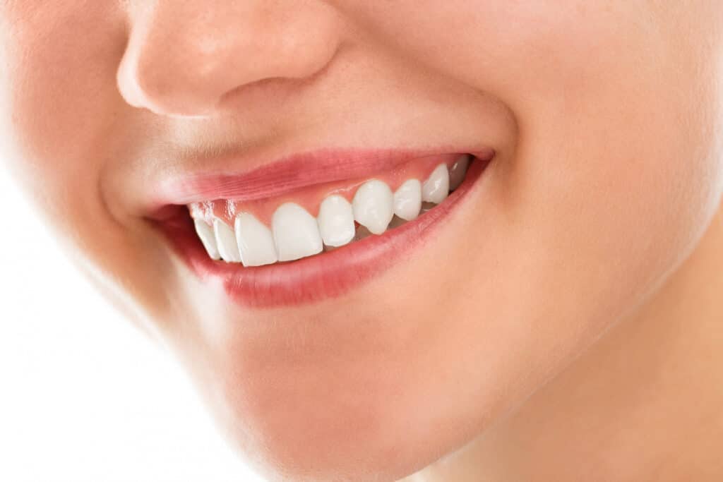 getting a dental crown