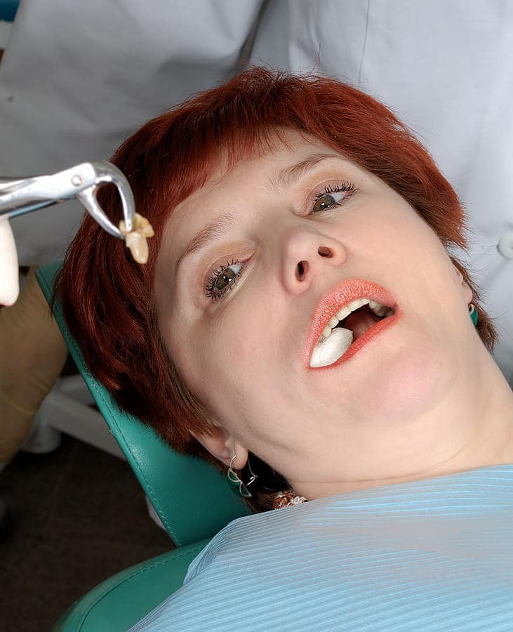 Tooth Extractions in Marysville
