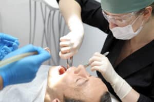 Diet after tooth extraction