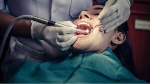 How long does a dental extraction take?