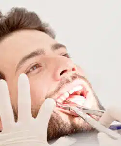 Cost of Tooth Extraction