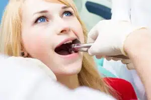 Tooth Extraction Pricing Guide
