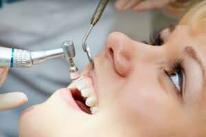 Dental cleaning duration during a woman’s dental visit