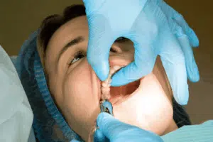 Doctor examining teeth to avoid root canal