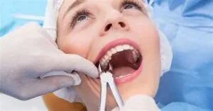Duration of a tooth extraction