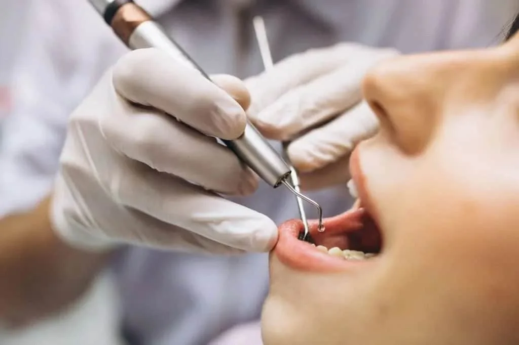 What Is The Cost of Dental Implants