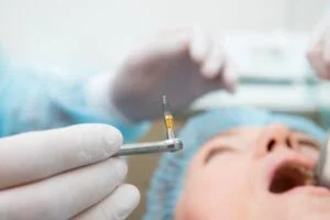 Cost of Dental Implants